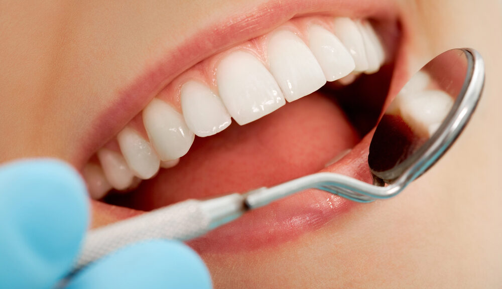 Come ottenere denti bianchissimi
